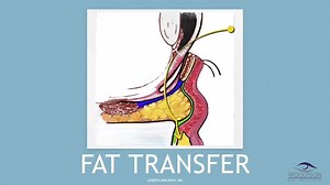 My Approach to Lower Blepharoplasty