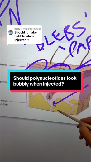 Polynucleotide Injections: Skin Boosters Explained