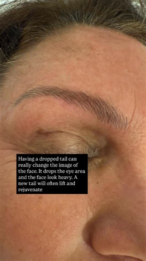 LONDON BROW CLINIC on Instagram: "Fresh and natural microblading by Galata at LondonBrowClinic. 5000 procedures carried out by Galata over 10 years. She works over the top of work by other artists too! £395 FIRST SET £195 TOP UP ON WORK BY ANOTHER ARTIST We are based on High St Kensington at The Royal Garden Hotel MediSpa BOOK BY CLICKING ON THE LINK We are London’s only microblading specialist clinic Medical pedigree 10 years of experience Microblading benefits women by providing a convenient a