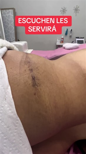 Postoperatoriograpevine on TikTok