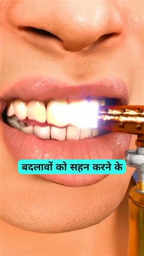 what if your teeth are missing