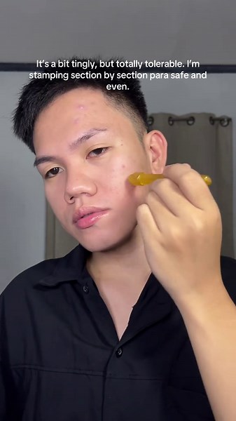 Achieve Clear, Glowing Skin with Derma Stamp Techniques