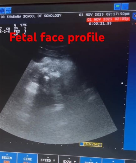 Dr. Shabana's School of Sonology. on Reels