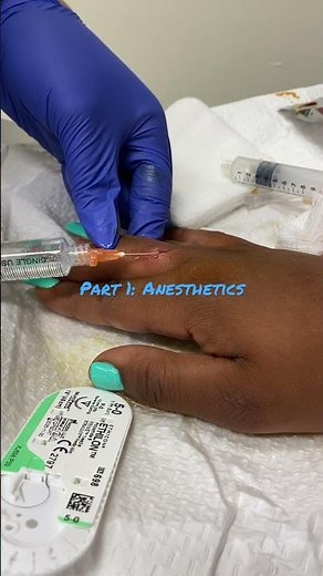 Infiltrating a Wound with Local Anesthetic before suturing