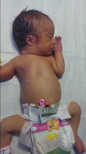 Premature Baby Newborn Feeding Problems | Causes, Signs & Care Tips #cutebaby #newbornbaby