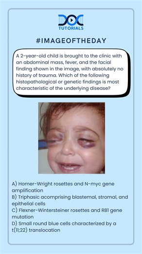 Which Histopathological or Genetic Finding Best Identifies the Disease?