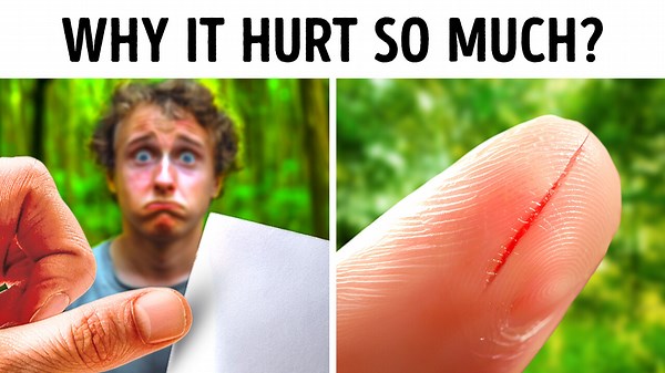 The Sneaky Pain of Paper Cuts: Why They Hurt So Much!