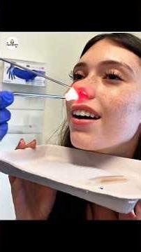 Red Light Nose therapy 🤕