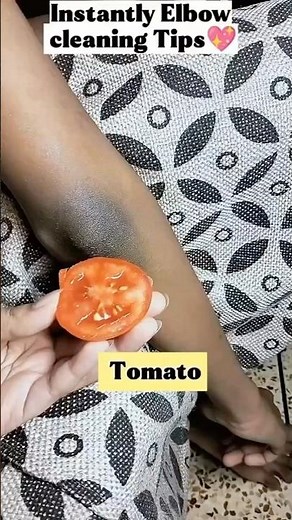 Elbow Cleaning Tips | Get Rid Of Dark Elbow/Clean Skin Dirt & Suntan #beauty #skincare #hack #shorts