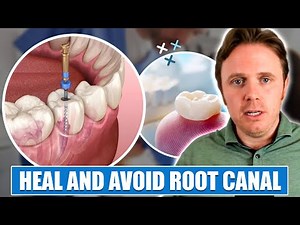 Dr. J's Cracked Tooth | How to Heal and Avoid Root Canal