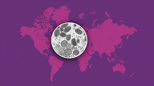 How do you test for monkeypox? What you need to know about highly contagious mpox virus.