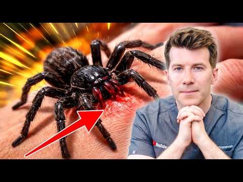 Spider Bite Treatment: When It’s Harmless vs Dangerous