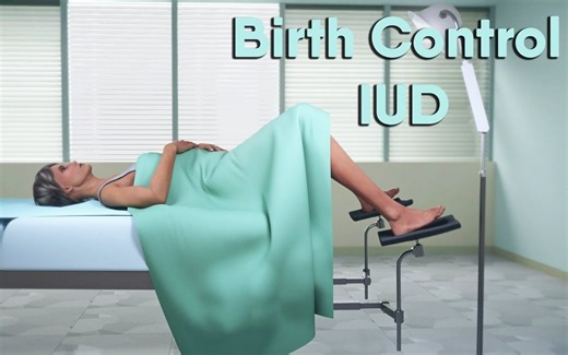 “上环”操作全过程 | 避孕环 | 医学动画