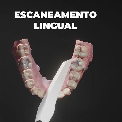 Sequencia completa de escaneamento