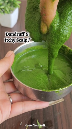 Dandruff And Itchy Scalp Home Remedy with 100% Result✨️Glow Yourself🌸 #Haircare