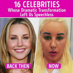 16 Celebrities Whose Dramatic Transformation Left Us Speechless | CelebRatings