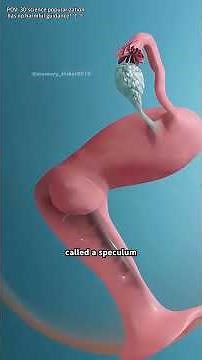 HPV Testing Explained (3D Animation)#HPVtesting #HPV #womenshealth #cervicalhealth #medical3d