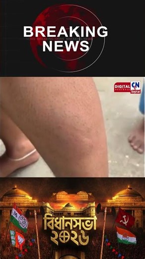 তারকেশ্বরে পুলিসের লাঠিচার্জ