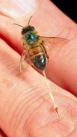 What to do if a bee bites #honeybee #honeybees #honeybeesting #honeybeerescue #honeybeeswarm | SQ Unique Fact