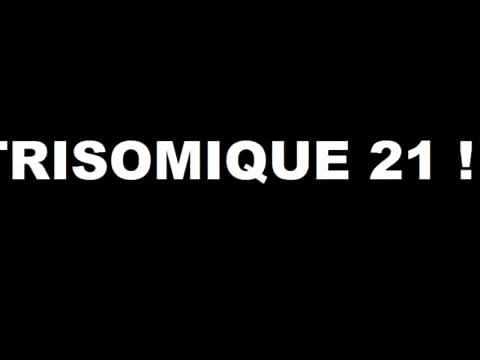 Musique trisomiques 21