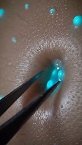 8.8K views · 976 reactions | Glowing liquid core extraction with smooth detail, surreal visuals, and perfect ASMR flow. #OddlySatisfying #relaxing | Synaptix Studioo | Facebook