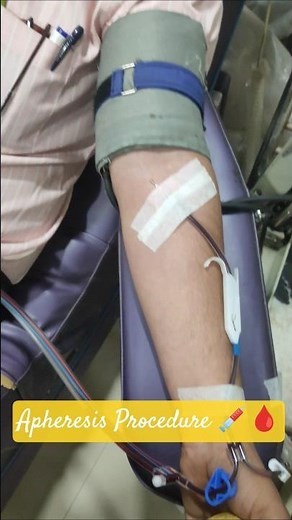 ✨🩸 Apheresis Procedure #apheresis #labtechnician #viral #ytshorts #trending #bloodbank #hospital