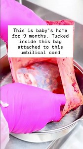 Wild 😝 #baby #placenta #placentaencapsulation #pregnant #postpartum #pregnancy