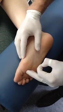Flexor Hallucis Brevis Dry Needling