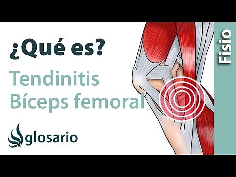 TENDINITIS DEL BÍCEPS FEMORAL | ¿Qué es?