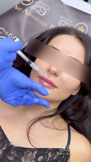 Cea mai avansată tehnică de injectare ✅ Tehnica #beautyartaesthetics...