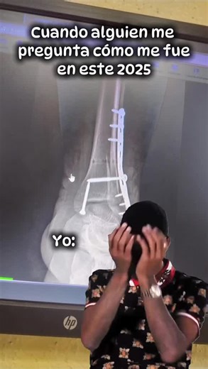 #LIVEIncentiveProgram #LIVEStory #PaidPartnership #lesion #vamos