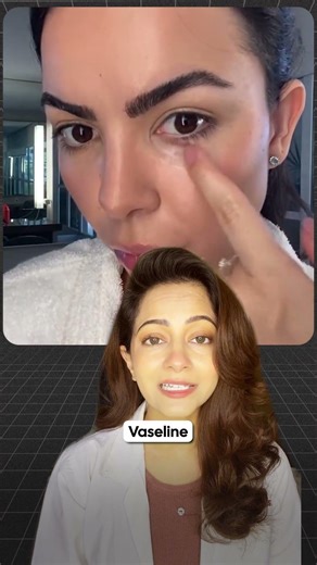 Vaseline under your eyes a good idea?