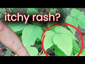 Poison Ivy & Poison Oak: Identify, Prevent, and treat the Itchy Rash!| Dr. Victoria, MD