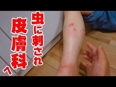 【閲覧注意】虫刺されすぎて皮膚科に直行。。。