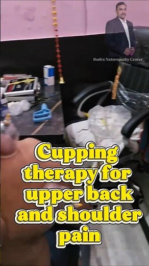 Cupping Therapy An Effective Ways To Heal Upper Back or Shoulder or Muscle Stiffness ✨️