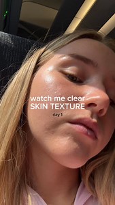 HOW TO CLEAR TEXTURE ⬇️ Step 1 – Unclog your pores🫧 Texture often starts when pores get blocked. Use ingredients like salicylic acid because they clean your pores from the inside out (removing excess oil dead skin). Usage: 1–2x a week if you’re new, 2-3x if your skin tolerates it. Step 2 – Start a retinoid🧴 Retinoids increase cell turnover, which clears texture, and prevents new bumps from forming. It’s my #1 ingredient for texture. ✨ Comment TEXTURE and I’ll DM you the one I use! Step 3 – Rem