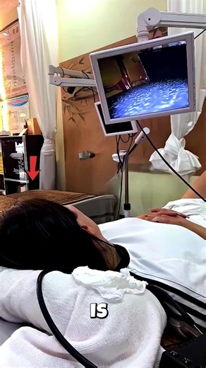 The doctor checked the girl's ear with a machine#viral #trendig #foryoupage❤️❤️ #foryou #facts