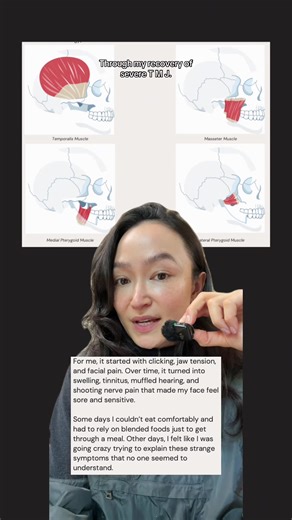 If you’re struggling with TMJ and nothing is working, understanding the muscles around your jaw may be the missing piece. The jaw is supported by a group of muscles that can either help stabilise the joint and reduce pressure - or overcompensate when the joint is under constant load. What finally helped me was understanding how jaw position, posture, daily habits, and targeted muscle work affect the pressure on the TMJ. Reducing TMJ compression through better mechanics changed everything for me 
