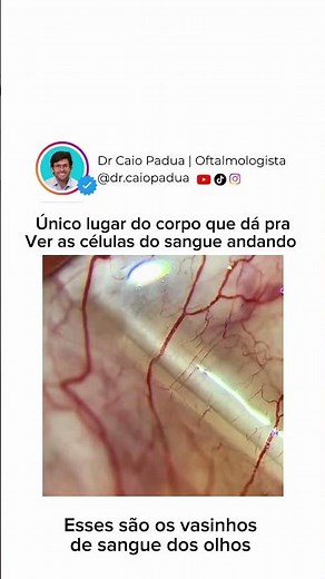 Único lugar do corpo que dá pr a ver as células do sangue andando