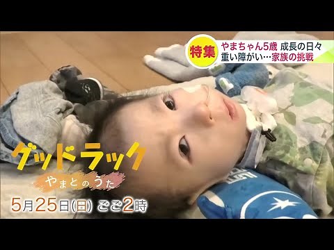 重い障がい“18トリソミー”医療的ケア児と家族の1年 「1歳まで生きることができるのは1割」チャレンジと成長の日々…ドキュメンタリー『グッドラック やまとのうた』5月25日放送 ナレーター泉谷星奈さん