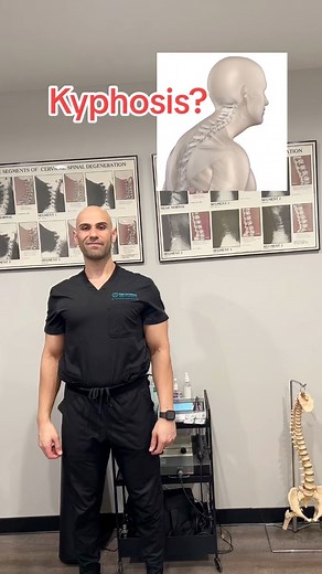 1M views · 9.1K reactions | Kyphosis / Bad Posture? Try this and share!#kyphosis #kyphosisexercises #posture #badposture #posturecorrection #postureexercises #posturetips #forwardheadposture #tips #viral | Prime Performance Chiropractic & Wellness Clinic | Facebook