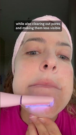 2 in 1 Facial Exfoliation & Peach Fuzz Hair Removal System