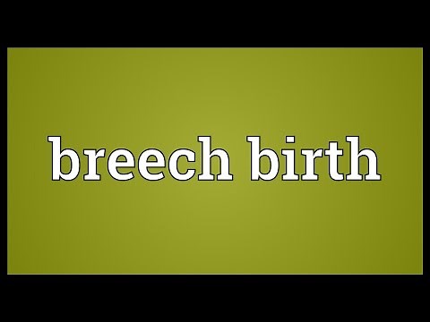 Breech birth Meaning