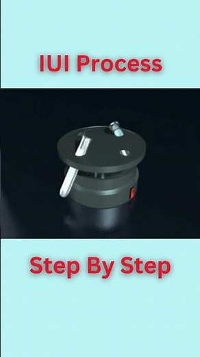 IUI Process step by step #iui #infertility #shorts