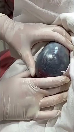 Moment of Labor: Baby Gently Descending Into Position | 3D Birth Visualization