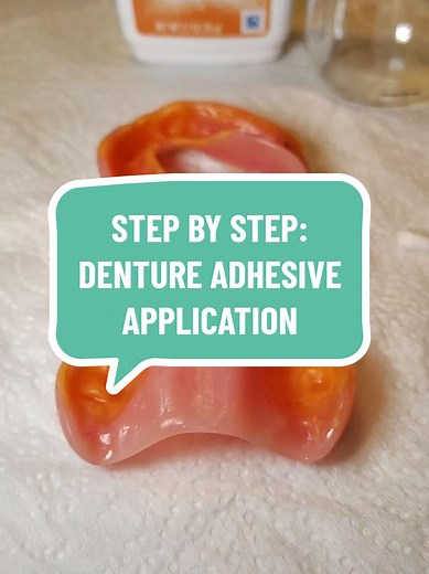 Step-by-Step Guide to Denture Adhesive Application