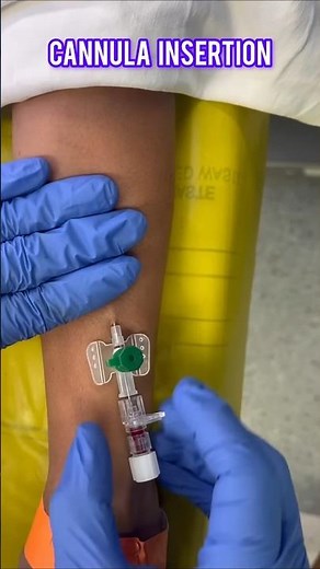 Cannulations | Cannula insertion|Cannulations Procedure