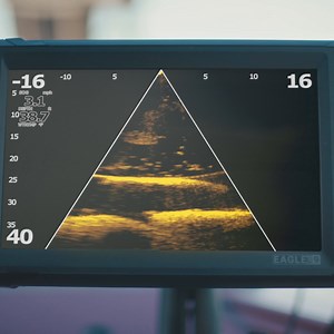 Meet Eagle Eye™—the world’s most accessible fishfinder with live sonar. Drop your lure right on the fish with live down view. | Lowrance