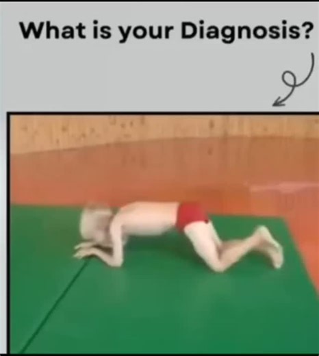 RK NURSE'S HUB | Duchenne muscular dystrophy (DMD) is a severe, inherited genetic disorder causing progressive muscle weakness and wasting, primarily in... | Instagram