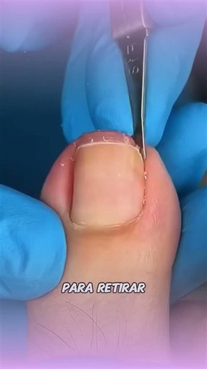 Would you like to learn aesthetic pedicures, foot spas, and ingrown toenail techniques? 👣✨